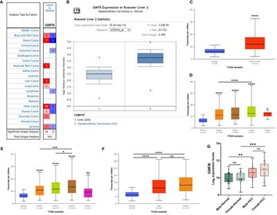 Glia Maturation Factor Beta as a Novel Biomarker and Therapeutic Target for Hepatocellular Carcinoma